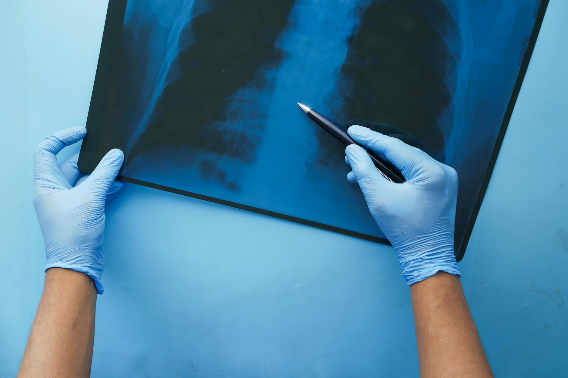 a person holding an x ray result